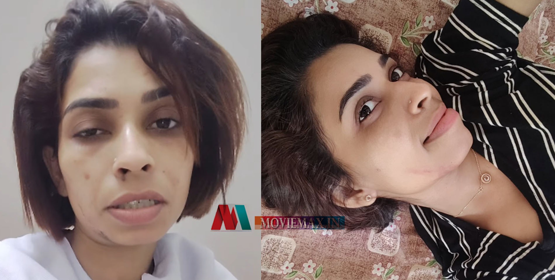 'മുഖത്തൊക്കെ പാടുകൾ വന്നു തുടങ്ങി, പ്രാർത്ഥന വേണം'; കീമോയുടെ വേദനയിലും ...